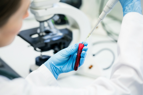Bluttest im Labor Bluttest im Labor