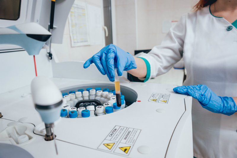 Separationstechnik in der Biochemie Separationstechnik in der Biochemie