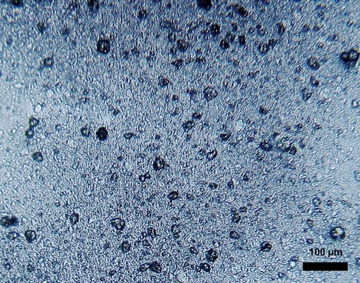 Mikroplastik in einer Zahnpasta Mikroplastik in einer Zahnpasta