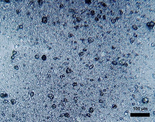 Mikroplastik in einer Zahnpasta