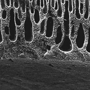 Dialyseschlauch aus regenerierter Cellulose - Standard