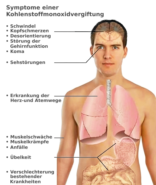 Symptome einer Kohlenmonoxid-Vergiftung