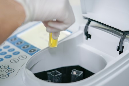 Analyse einer Probenlösung mittels Spektralphotometer Analyse einer Probenlösung mittels Spektralphotometer