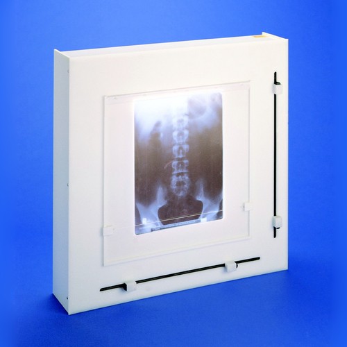 X-Ray Film Viewer