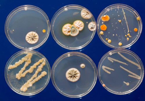 Verschiedene Bakterien- und Pilz-Kolonien in Petrischalen